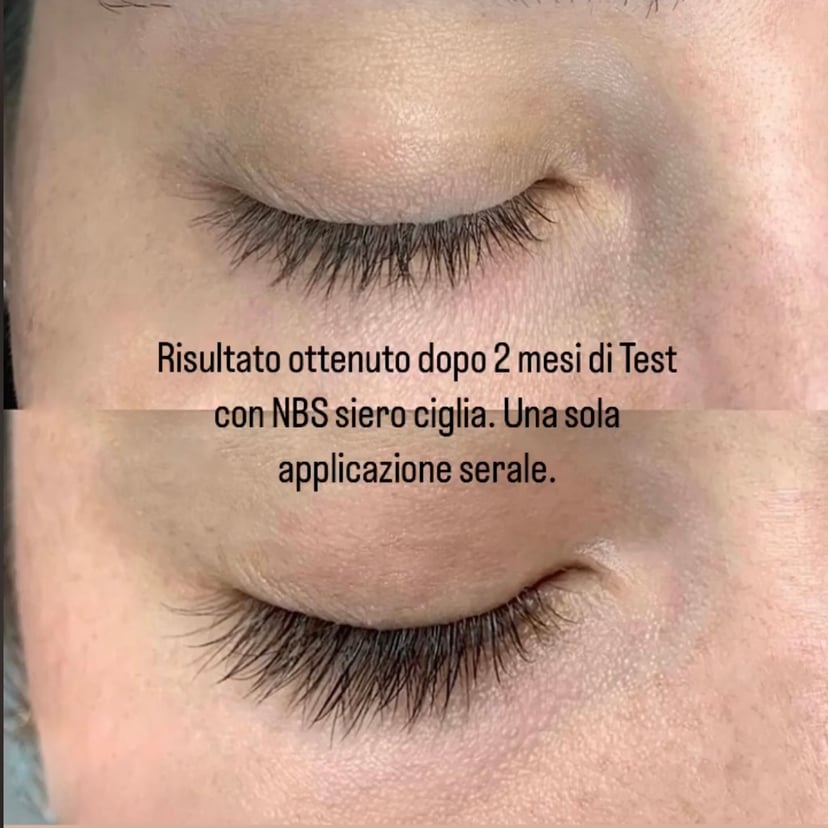 2 mesi, una sola applicazione serale